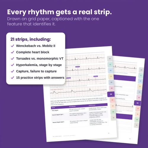 ICU Nurse Bedside Reference Guide