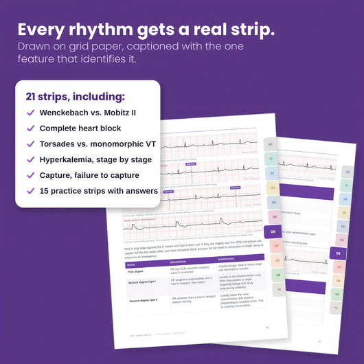 ICU Nurse Bedside Reference Guide